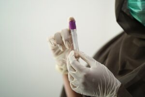 ヒゲの医療脱毛にかかる相場はどのくらい？